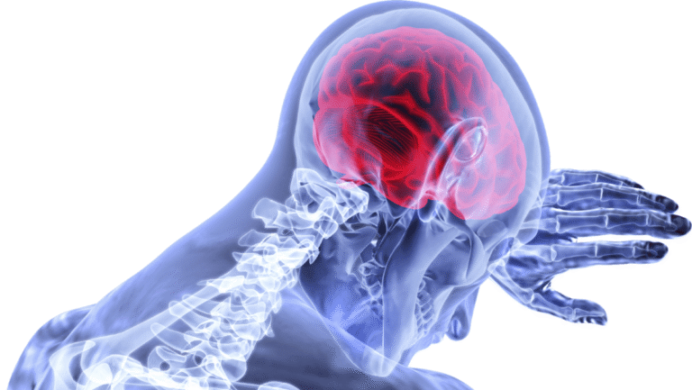 Expert Concussion Treatment in Houston: Heal Your Brain, Regain Your Life